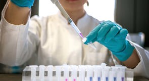 cinclus pharma female scientist working with pipette in lab